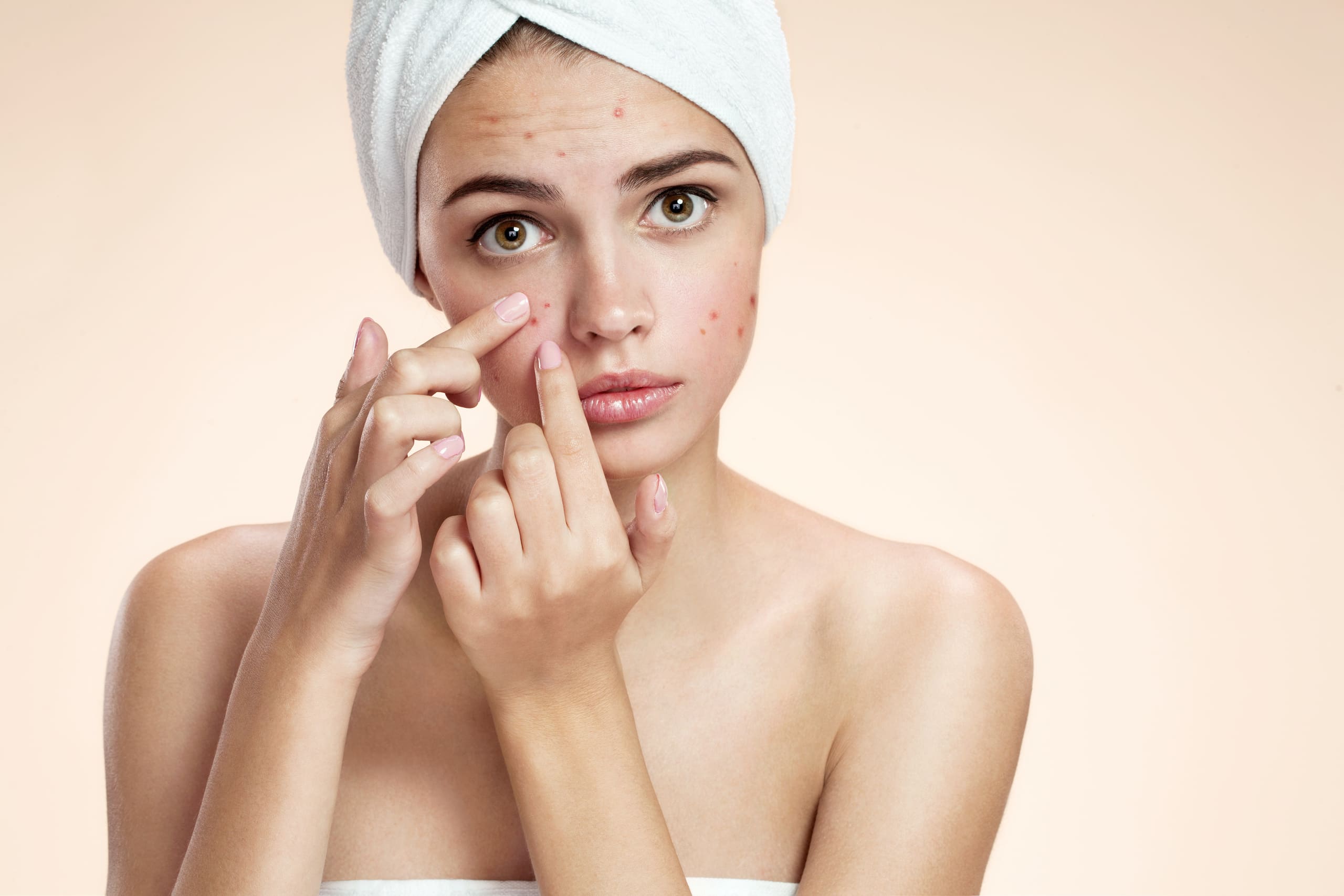 Towel Wrapped Woman Pointing her Acne | Noble Clinic in Draper, UT