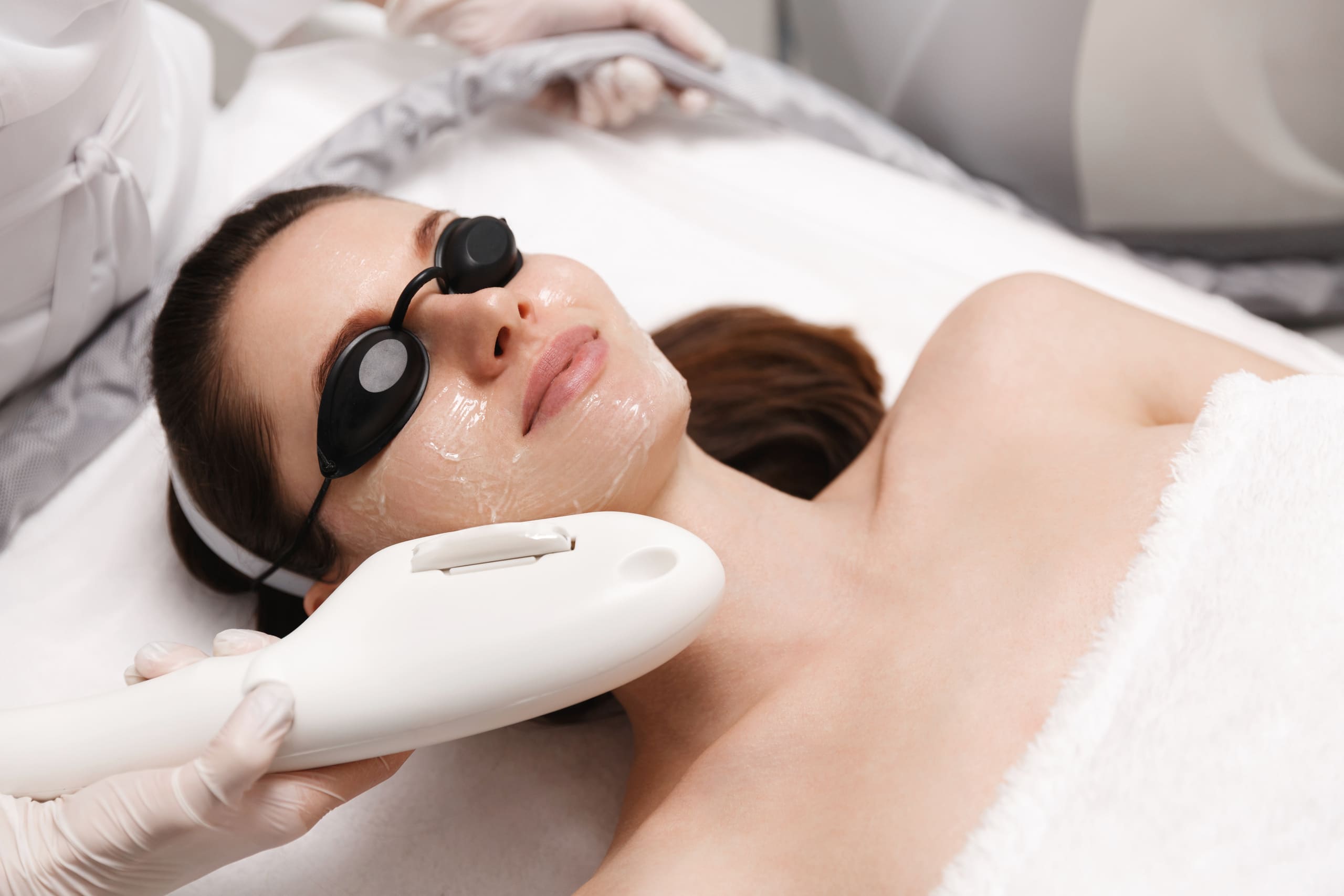 Woman Lying on Medical Cot & Receiving Laser Photo Facial Treatment | Noble Clinic in Draper, UT
