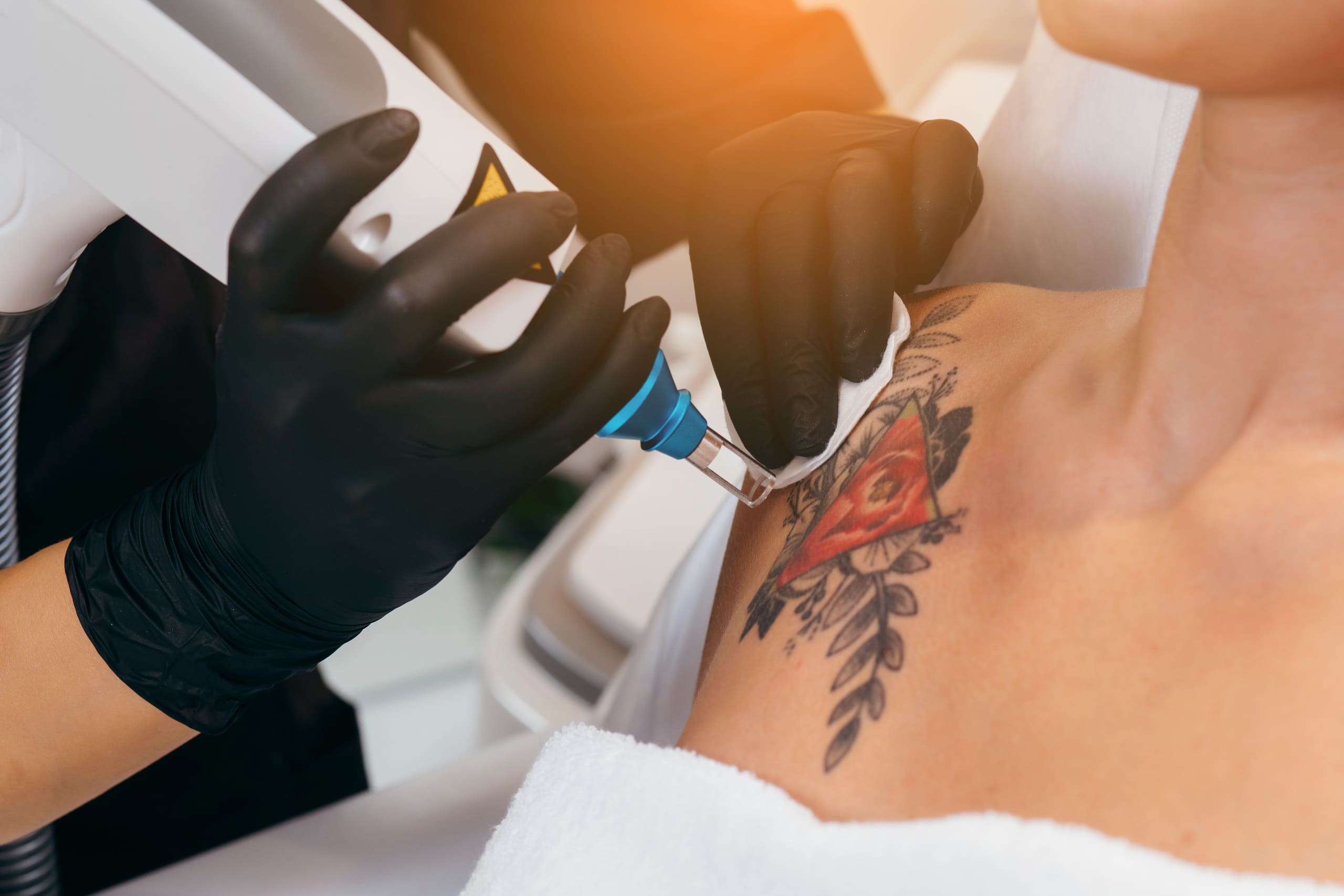 Beautician Wearing Black Hand Gloves Giving Tattoo Removal Treatment to Female Patient | Noble Clinic in Draper, UT