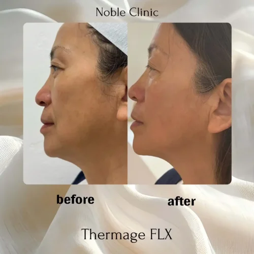 tharmage-zon-noble-clinic-in-draper-ut