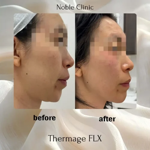tharmages-zon-noble-clinic-in-draper-ut